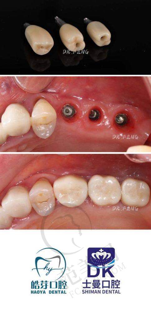 重庆上颌前突哪个好——重庆大坪医院详情