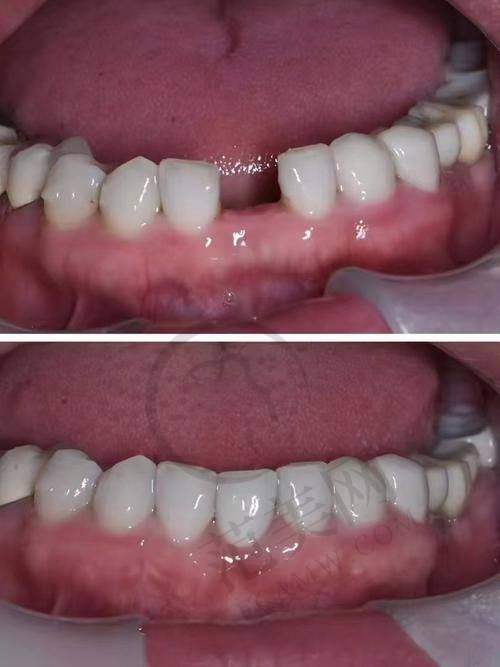 重庆上颌前突哪个好——重庆市人民医院详情