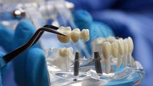 重庆附近哪家做瑞士士卓曼Straumann医院好——重庆大学附属三峡医院口腔分院