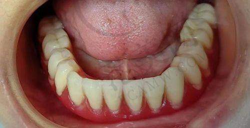 2025年重庆义齿医院排名——重庆同舟口腔