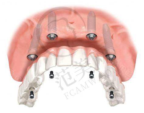重庆哪家医院可以做牙齿整形——重庆韩佳牙博士口腔医院