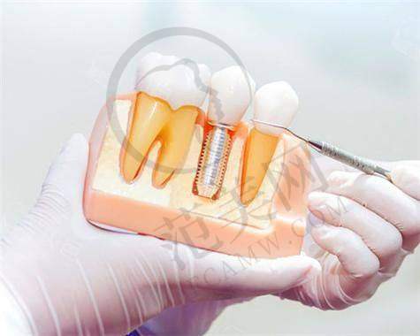 重庆美奥口腔医院(渝北嘉州路院)——精良设备的韩国美格真种植牙