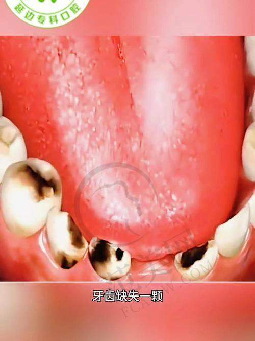 重庆比邻心口腔——专注韩国美格真种植牙技术