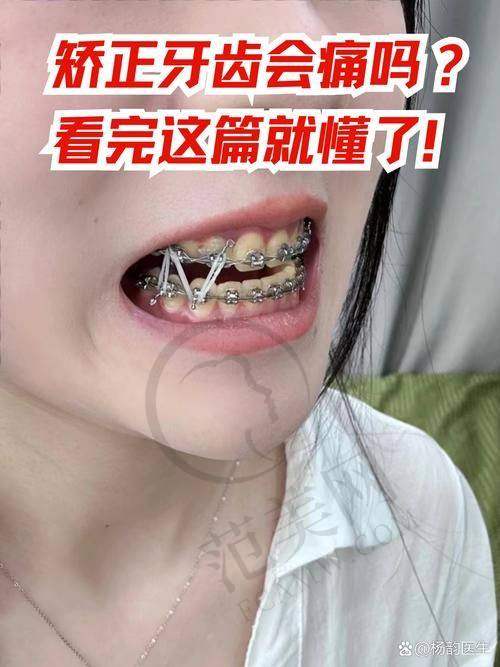 重庆贵金属烤瓷牙费用多少钱——重庆乐乐欣口腔