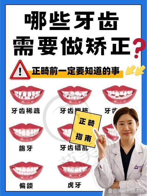 重庆哪家医院可以做牙齿整形——重庆美奥口腔医院