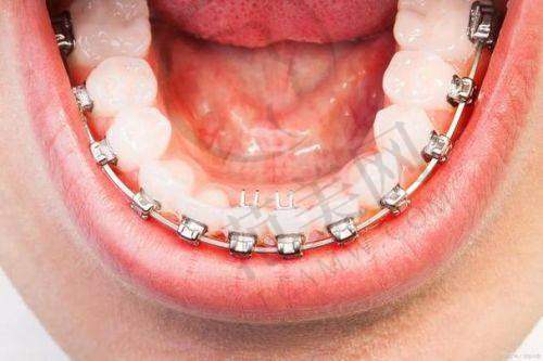 2025年重庆义齿医院排名:镶假牙好的10家医院揭晓,团圆/牙博士等含张华医生擅长高龄全口修复