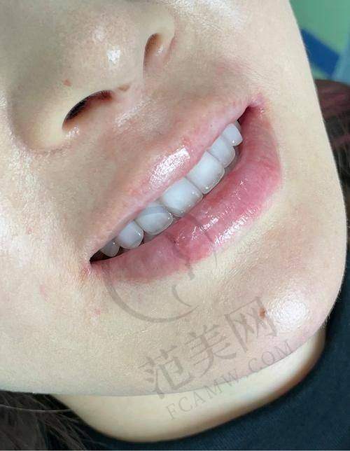 重庆美容冠美白手术价格一览表之医院价格详情