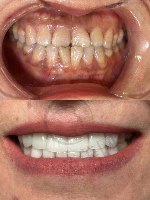 唐山深龋医院价格对比与其他口腔项目关联