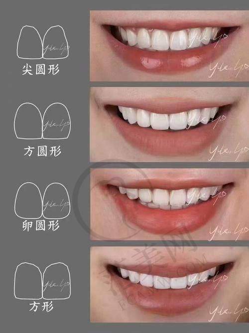 重庆德国AKLAS种植牙医院价格趋势分析