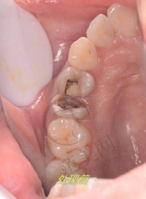 唐山深龋医院价格对比影响因素