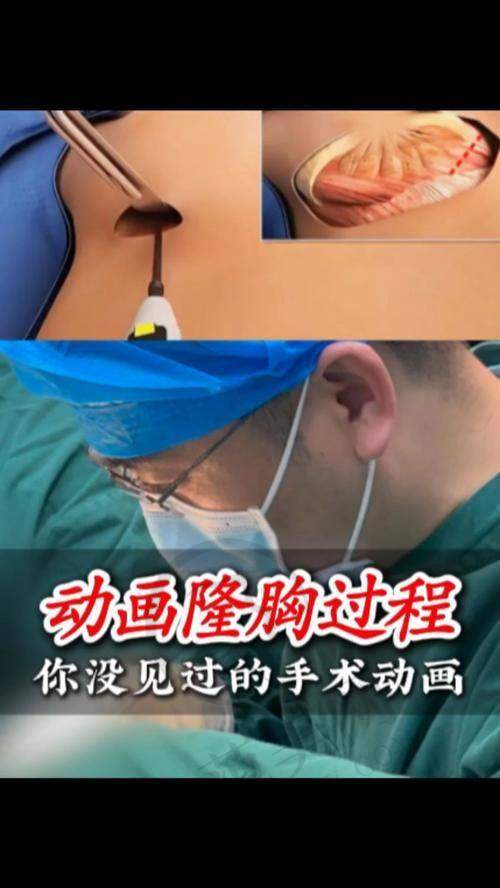 龙岩爱丽诺医疗美容门诊部顾客实例