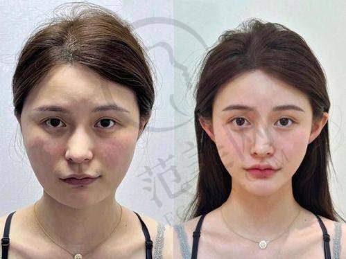 三亚艾美尔医疗美容门诊医生简介