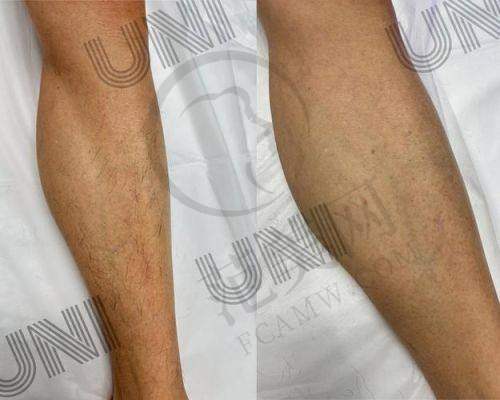 龙岩爱丽诺医疗美容门诊部怎么样