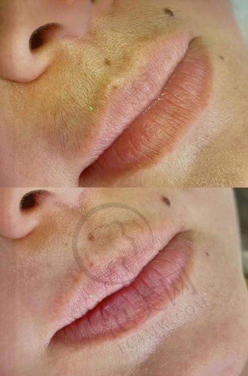 三亚艾美尔医疗美容门诊口碑情况