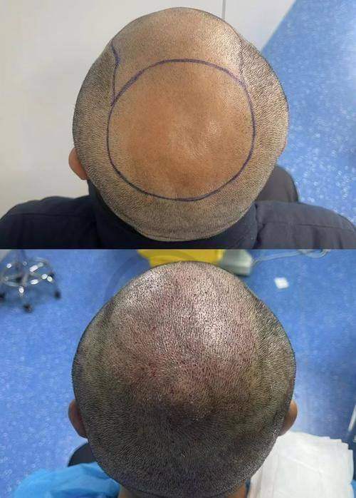 龙岩爱丽诺医疗美容门诊部价格表