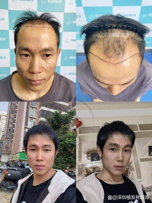 三亚艾美尔医疗美容门诊医生具体情况