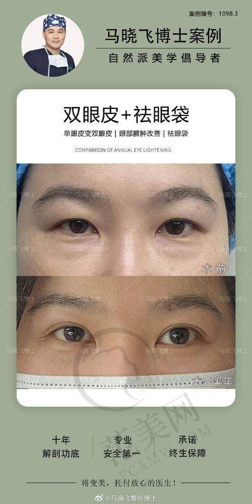 杭州鬓角种植官网认证医院——杭州雍禾美度医疗美容诊所