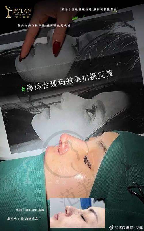 杭州鬓角种植官网认证医院——浙江大学医学校附属第二医院