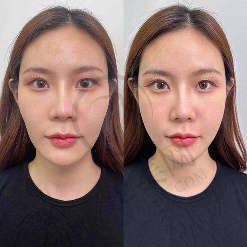 杭州做轮廓三件套更出名的三家医院——杭州圣茜医疗美容有限公司