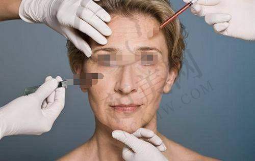 杭州拉皮手术提升官网认证医生——省立同德医院