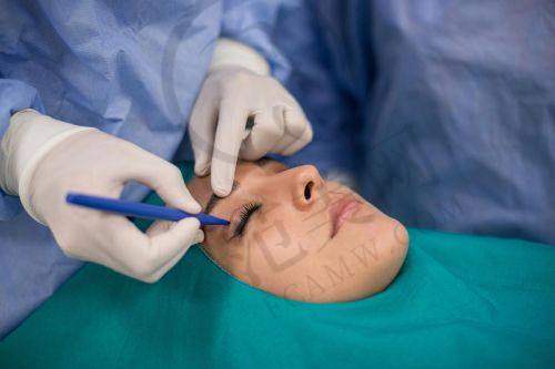 杭州拉皮手术提升官网认证医生——杭州格莱美医疗美容医院