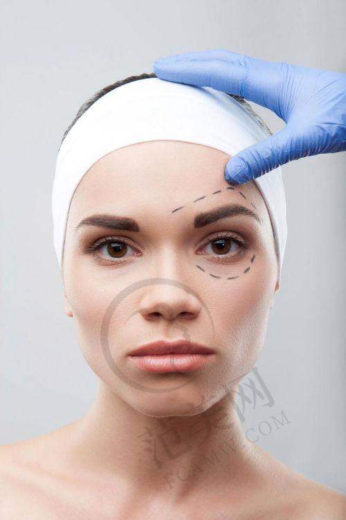 杭州拉皮手术提升官网认证医生——浙医二院