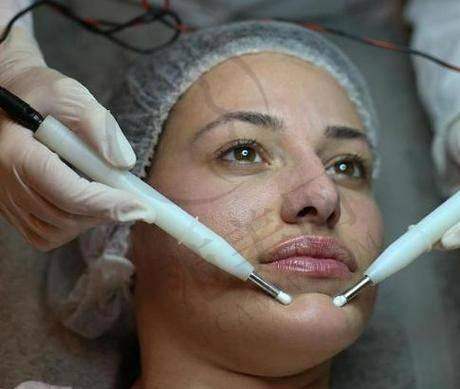 杭州拉皮手术提升官网认证医生——浙江省中医院