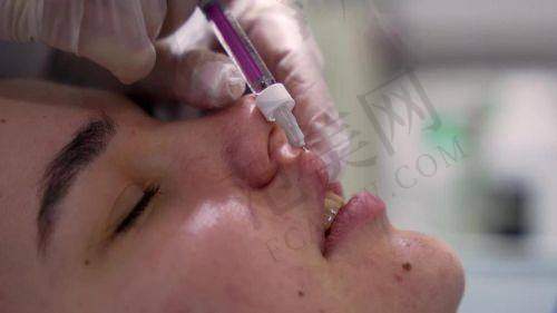 杭州收缩毛孔最牛的医生排名:浙大附一吴慧玲、孙晓琦等擅长收缩毛孔实力强