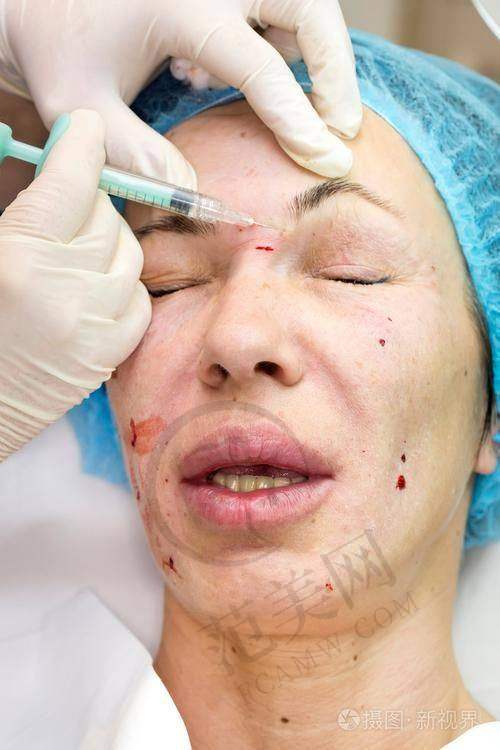 杭州收缩毛孔更牛的医生排名——杭州世彩医疗美容诊所