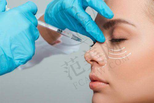 杭州做下巴吸脂术医院排行榜——杭州瑞丽医疗美容医院