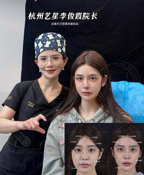 杭州注射祛法令纹性价比排名——杭州维多利亚