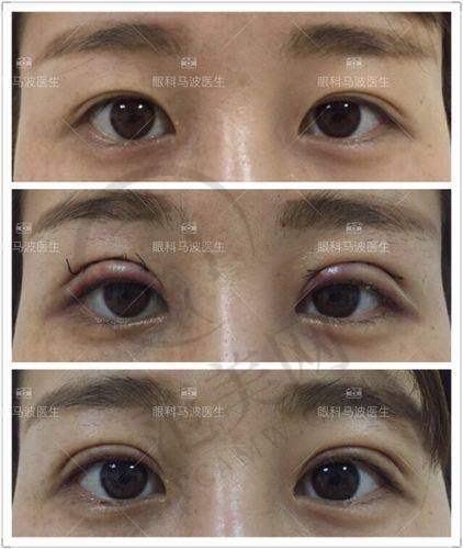 杭州毛发移植医院排名:公立浙一/连锁大麦技术口碑对比榜