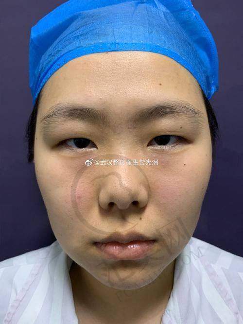 杭州眉毛种植最权威的医院口碑排名：2025前五医院出炉|余杭区中医院/第三人民医院等上榜