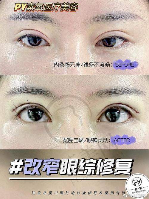 杭州丰眉弓更厉害三个医生——杭州浮想国医疗美容