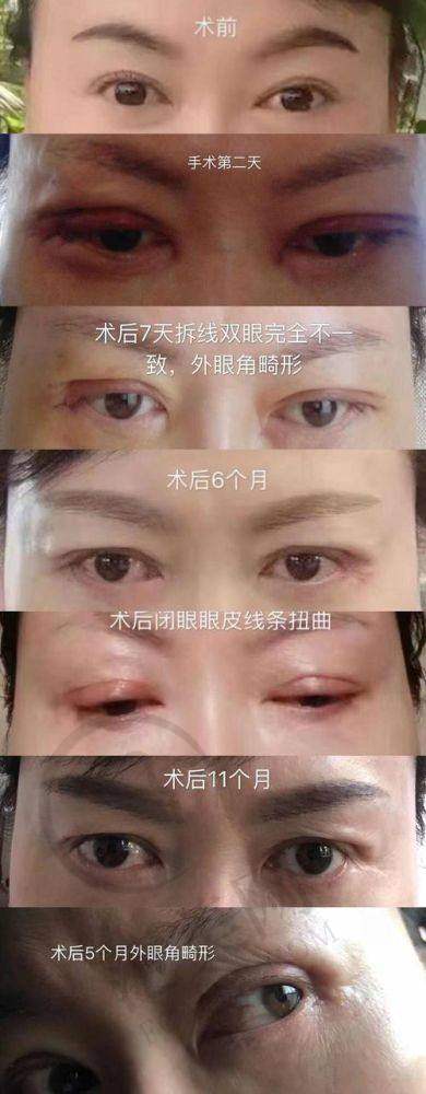 杭州丰眉弓更厉害三个医生——杭州瑞丽医疗美容医院