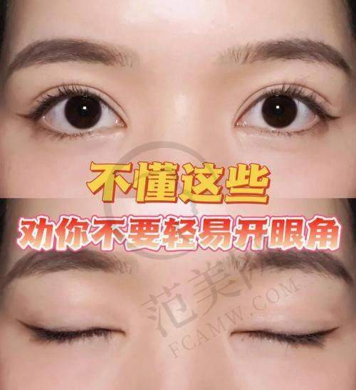 杭州双眼皮医生哪个好——杭州爱琴海医疗美容门诊部
