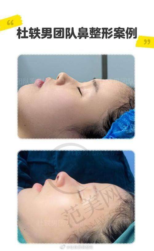 杭州胎记疤痕治疗——杭州肤康医疗美容皮肤专科医院