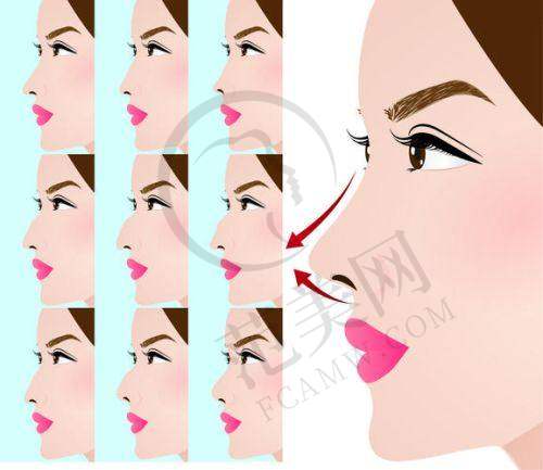 杭州胎记疤痕治疗——杭州丽脂医疗美容门诊部