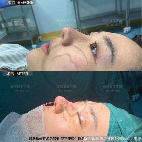 杭州毛发移植医院排名——杭州瑞丽植发医院