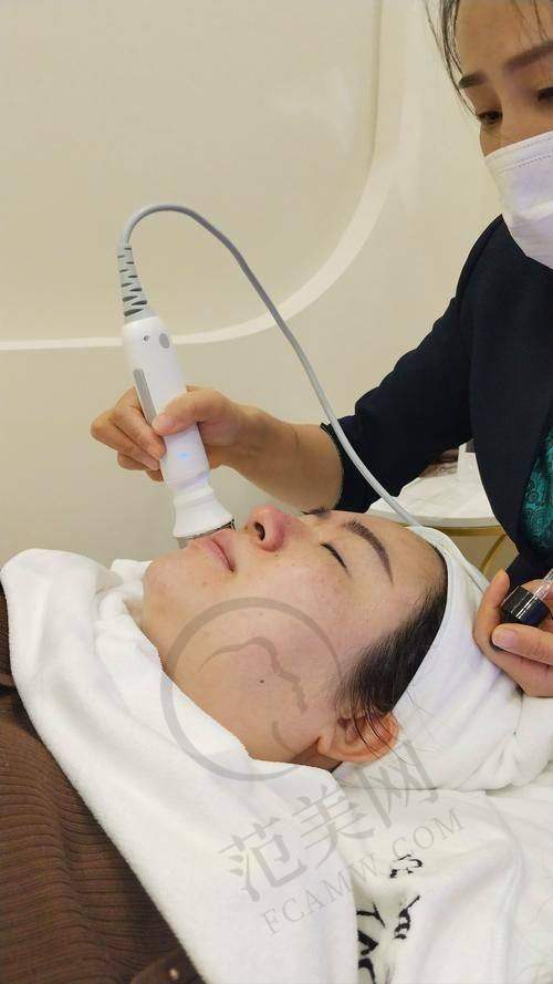 杭州红蓝光祛痘又好又便宜的医院——杭州市红十字会医院