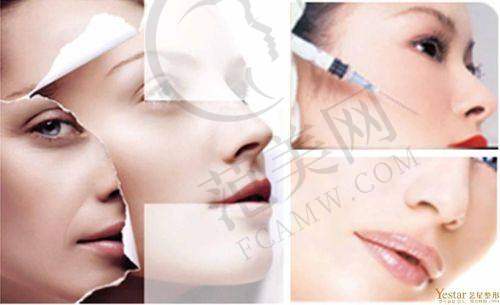 杭州丰眉弓更厉害三个医生——杭州美莱整形医院