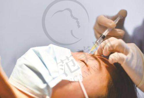 杭州丰眉弓更厉害三个医生——杭州时光医疗美容医院