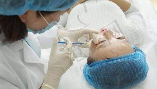 杭州自体脂肪去法令纹预约门诊——杭州天鑫医疗美容医院