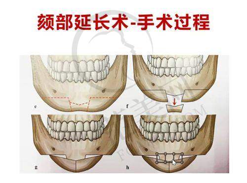 上海江城医院皮肤科咋样？特色中西医诊疗+雄厚专家团队，患者评价好还能线上预约