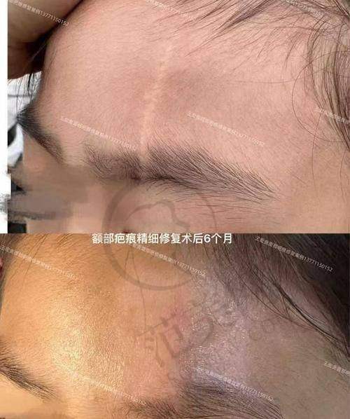 上海江城医院皮肤科精良设备