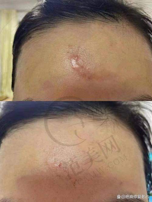 上海江城医院皮肤科特色项目