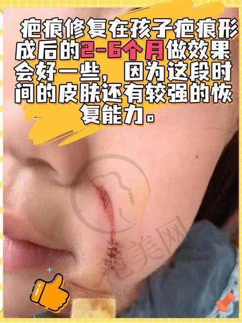 上海江城医院皮肤科就诊交通