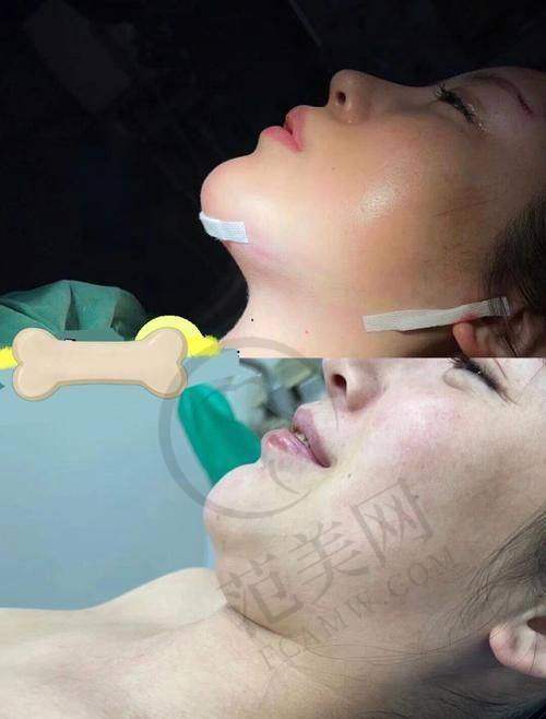 上海江城医院皮肤科社会公益