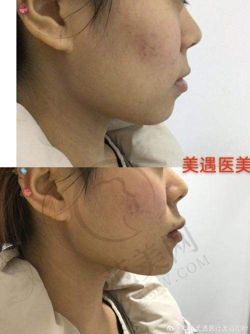 上海江城医院皮肤科服务理念