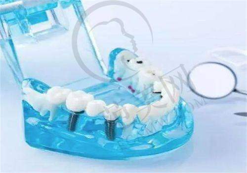 杭州美奥口腔(西湖店)医生简介